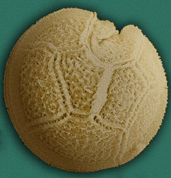 Altra specie di Peridiniales (Peridinium gatunense)